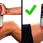 Gym Hacks – 26 FIRST AID TIPS EVERYONE MUST KNOW